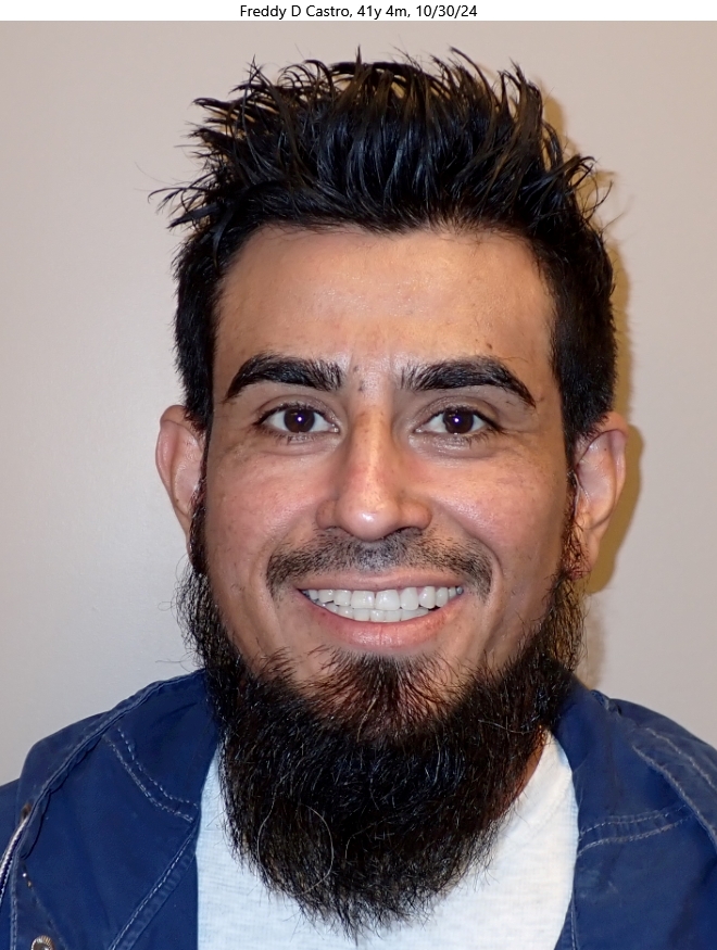 Before patient - Freddy