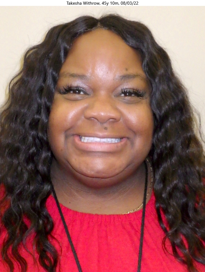 Before patient - Takesha