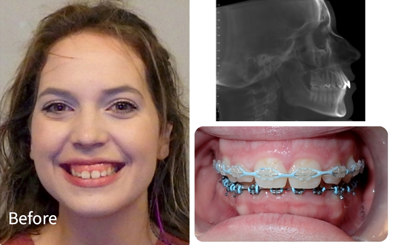 Before patient - Case J